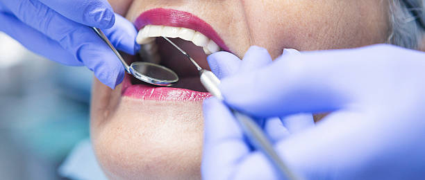 Best Emergency Treatment for Dental Infections or Abscesses in Wilkinson Heights, SC